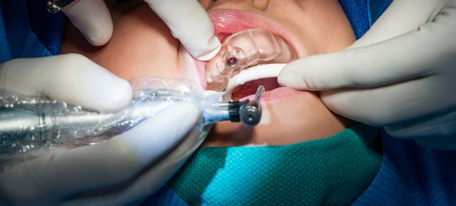 Formlabs創(chuàng)舉 生物相容性3D打印樹脂Dental SG誕生記
3d打印樹脂,3d打印樹脂材料,3d打印材料有哪些,3d打印材料價(jià)格,3d打印耗材,大連3d打印,大連3d打印機(jī),大連3d打印公司