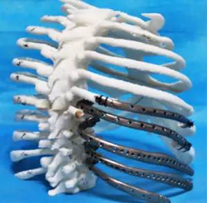 第四軍醫(yī)大學(xué)精彩分享個(gè)性化醫(yī)療3D打印的實(shí)戰(zhàn)案例與研究成果 第四軍醫(yī)大學(xué)精彩分享個(gè)性化醫(yī)療3D打印的實(shí)戰(zhàn)案例與研究成果